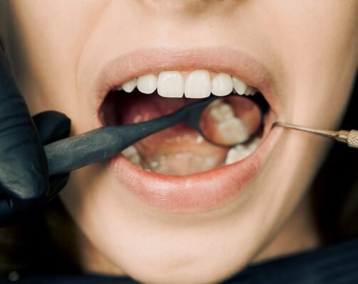 Ağız ve Diş Sağlığı İçin Probiyotik